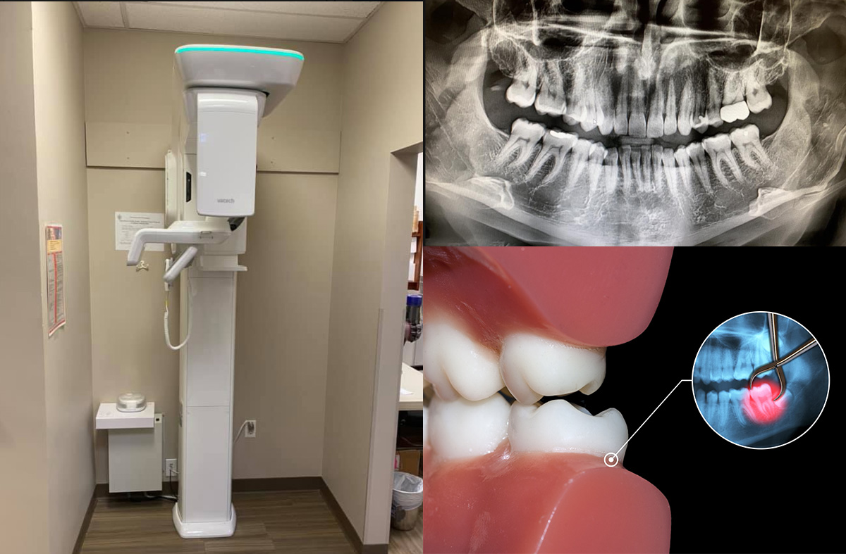 Dental Cone Beam 3d Imaging Brookline
