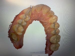cosmetic dentist 3D scan brookline