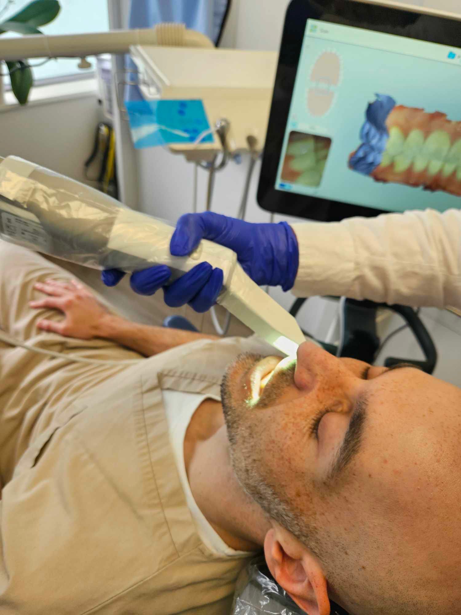 How iTero™ Intraoral Scanners Enhance Your Invisalign Experience